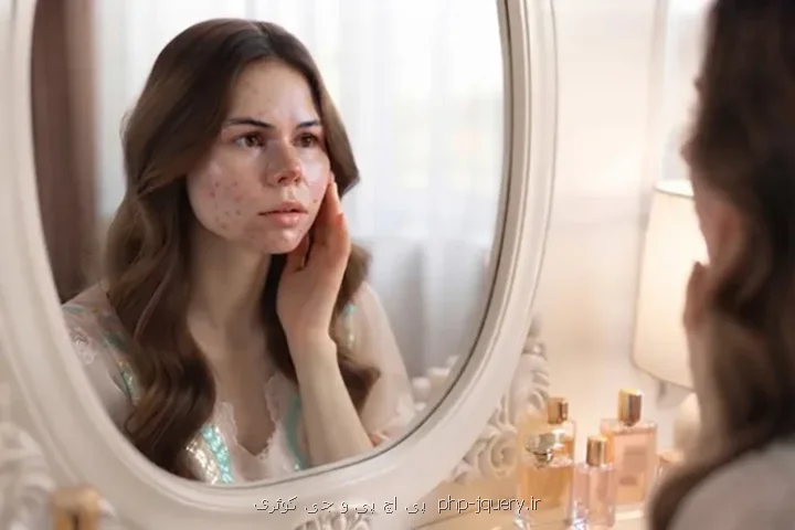 چرا هر کاری می کنم باز هم جوش می زنم؟